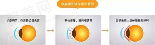 海口博创医院眼科硬件设备精良！