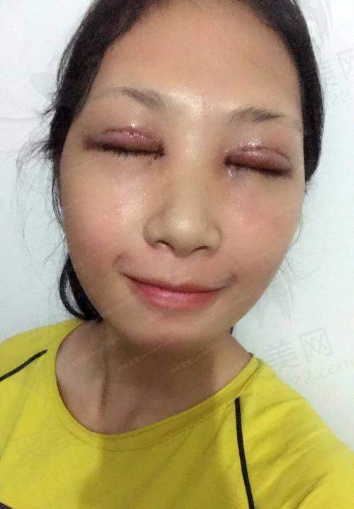 深圳阳光医疗美容医院李鹏医生的详细介绍