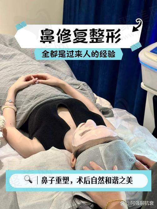 重庆艺星朱家旭半肋鼻综合12949元起——总结