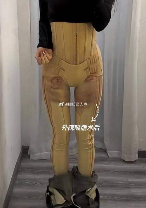 总结