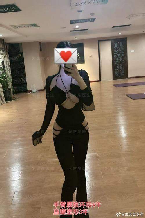 重庆艺星朱家旭腰腹水动力吸脂的术后护理
