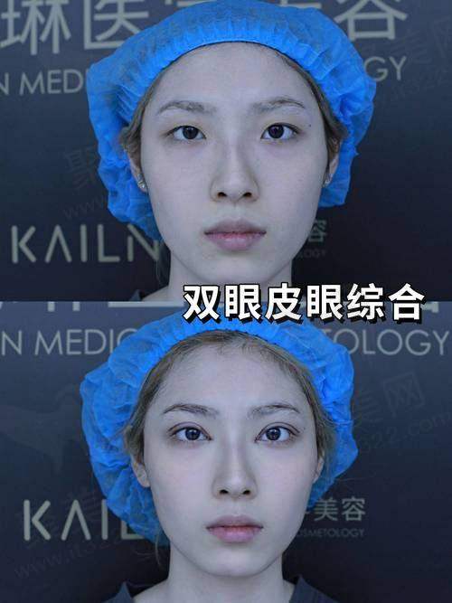 七、郭栓全医生真实的患者评价