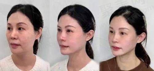 四、郭栓全医生口碑怎么样？
