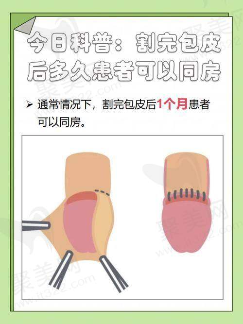 成都友谊整形包皮环切吻合术8800元起，微创无痛精准切除助你快速恢复美观无忧