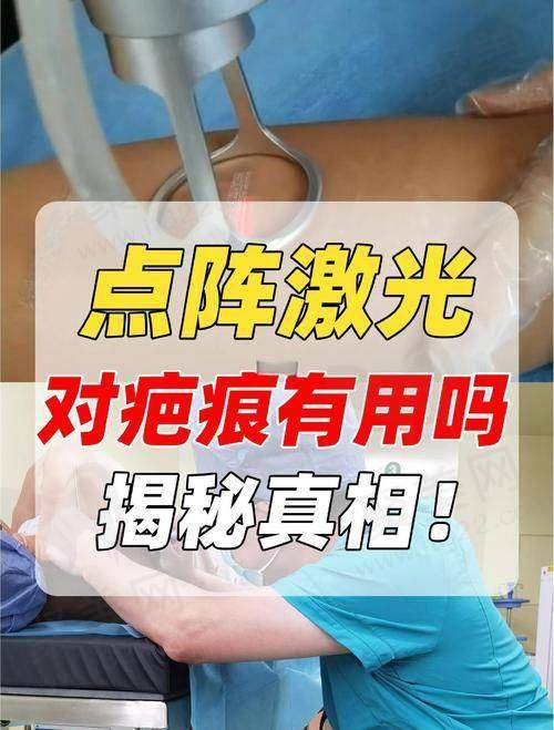 上海虹桥医院点阵激光除痘坑原价2000多元，现780元起一次多设备应对不同痘坑！