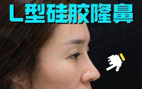 成都友谊整形医院整体情况怎么样？