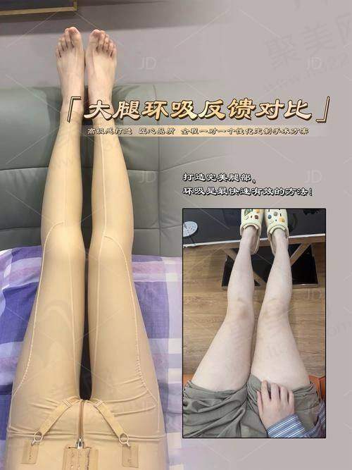 全身吸脂手术价格分析：医院减肥多少钱一次，医保卡能否报销？