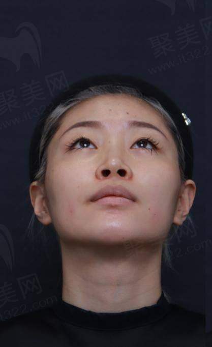 成都友谊整形医院本身有什么优势？