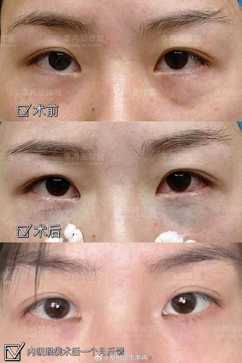 深圳阳光医疗美容医院李鹏医生介绍