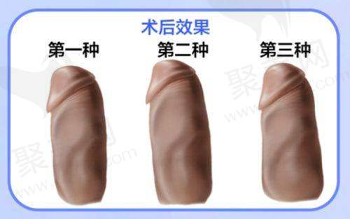 五、郑州芊美整形预约挂号流程：