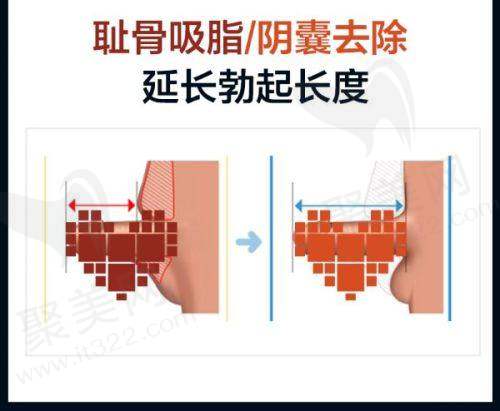 成都中医大银海医美是什么时候开的？医院1956年成立科室多样服务丰富
