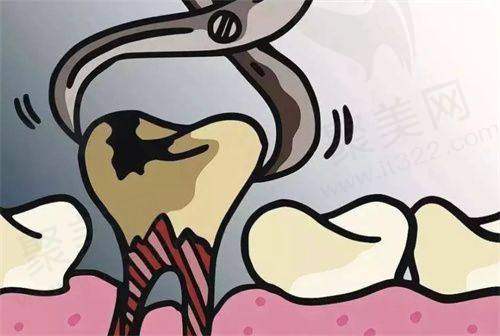 一、厦门麦芽口腔医院拔牙价格总体概况