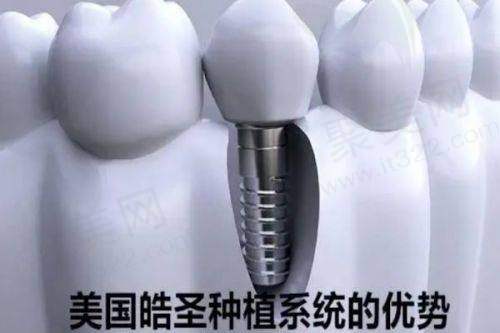 四、兰州皓亚口腔的收费价格