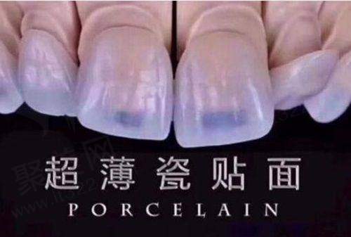 三、蚌埠皖美口腔医院就诊优势