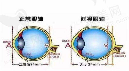 郑州视献眼科高月医生值得选吗？