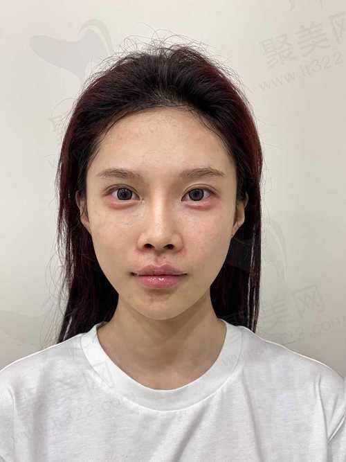 如何结合自身情况选择适合的做卧蚕方式？