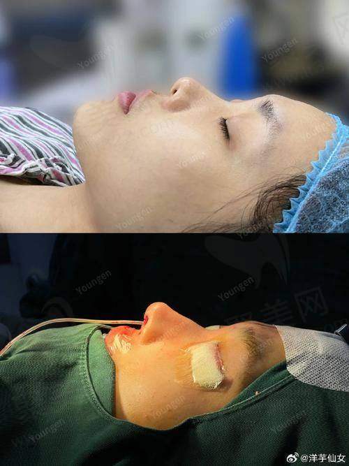 重庆艺星朱家旭耳软骨鼻综合9750元起的价格分析
