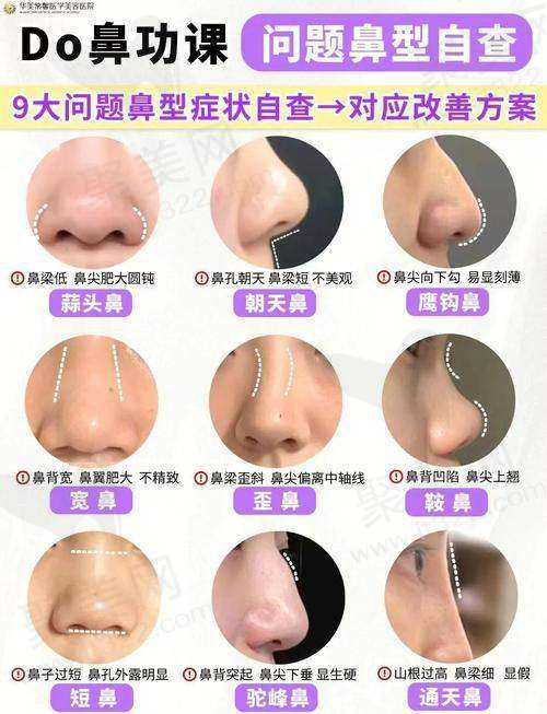 广州韩妃刘志刚医生做隆鼻怎么样？