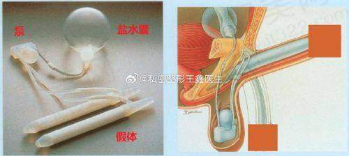 男科挂什么科室的号？生殖系统炎症选对科室特别重要