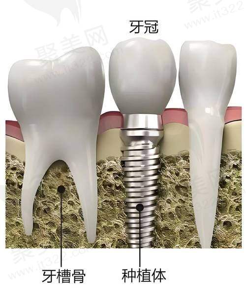 八、湛江华美口腔