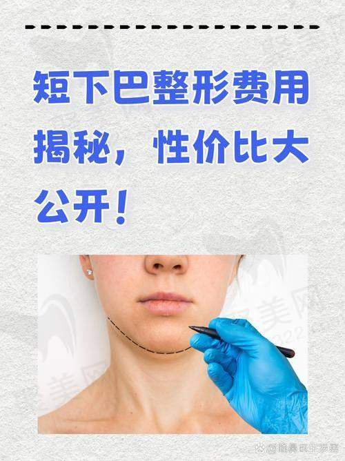 重庆艺星朱家旭硅胶假体垫下巴的成效与实例