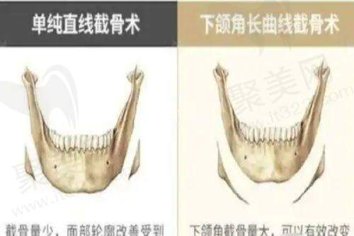 宁波鄞州嘉莱美医疗美容门诊部患者评价