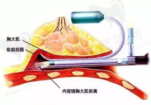韩国优雅斯线怎么样？成效反馈与用户实例