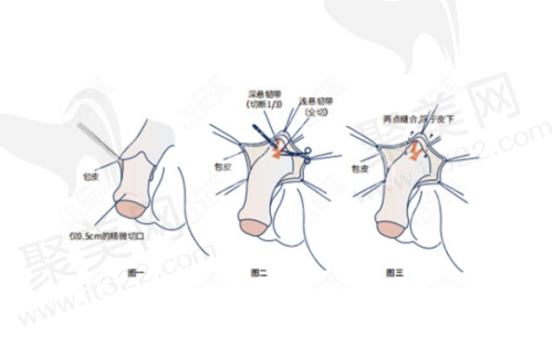 二、榆林美立方美容医院擅长的项目