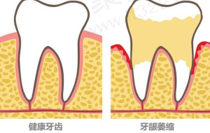 三、赤峰美加口腔患者真实口碑