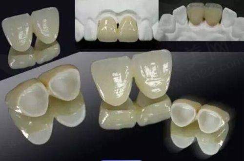 三、南宁贝壳口腔门诊部诊疗项目有哪些？