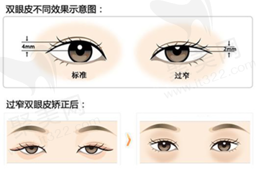 口碑评价