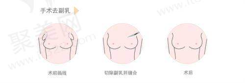 成都军大整形外科医院刘绪立医生的口碑评价