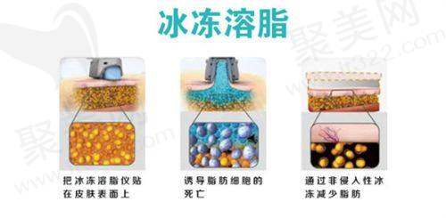上海翡立思和伯思立是一样吗？正规性、医生资源、特色项目大揭秘