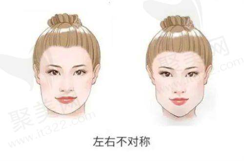 五、广州韩后整形医院医生预约攻略