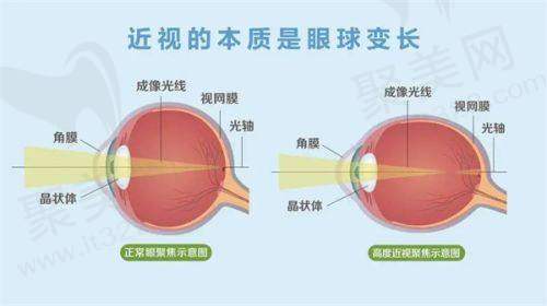 南宁爱尔眼科医院斜视矫正8000元起，经验医生操刀，个性化方案成就清晰视界