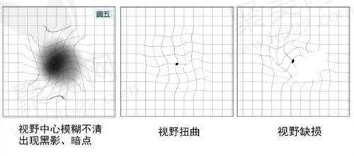 保定鹰华眼科叶子隆医生简介