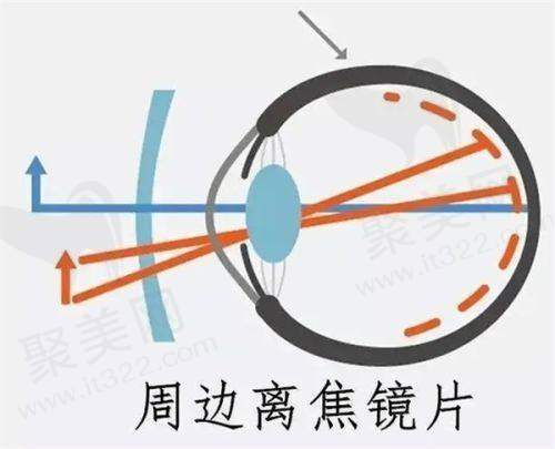 贵阳麦迪格眼科医院是国有医院吗？口碑评价怎么样