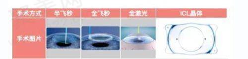 贵阳麦迪格眼科医院近视手术多少钱？8500元起多种术式价格、特点看这里