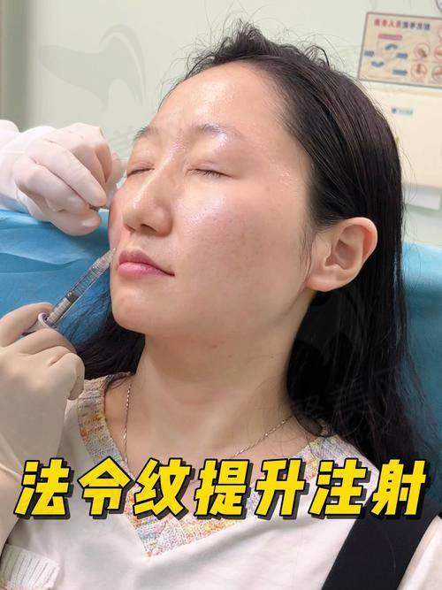 一、胶原蛋白填充法令纹的基本知识