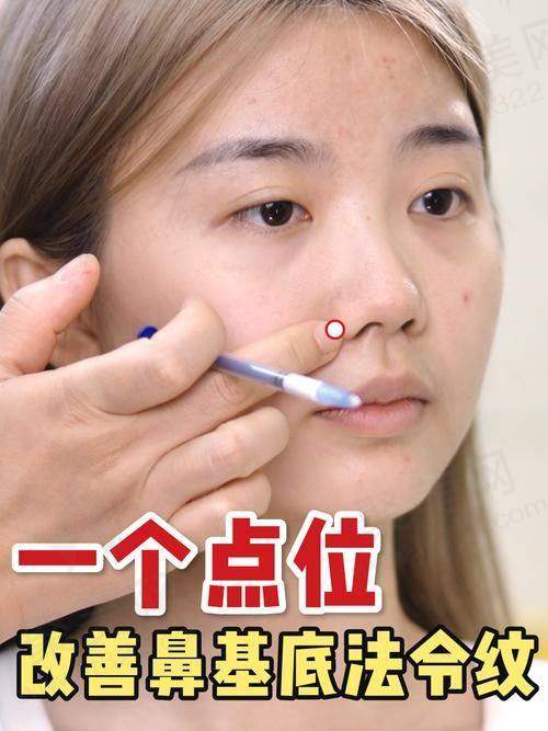 胶原蛋白填充法令纹