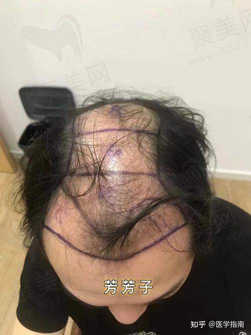 四、上海艺星医疗美容医院的优势
