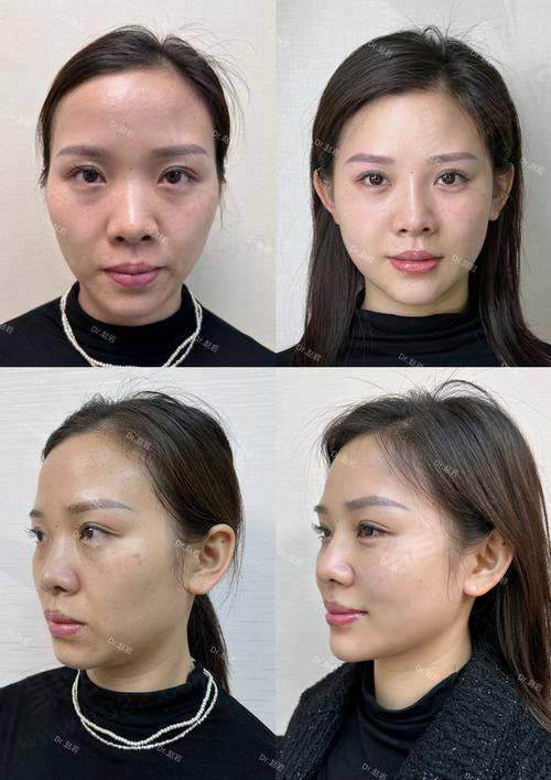 广州军美整形小V脸手术提升的医生团队
