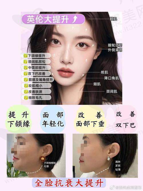 广州军美整形小V脸手术提升的作用和成效