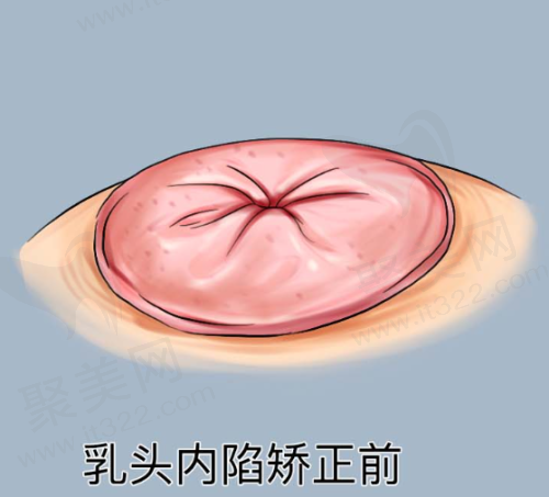 邯郸京美整形医院正规吗？