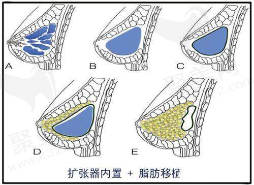邯郸京美整形医院预约挂号流程：