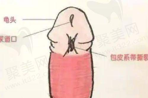 上海华美四代热玛吉900发项目的具体优势