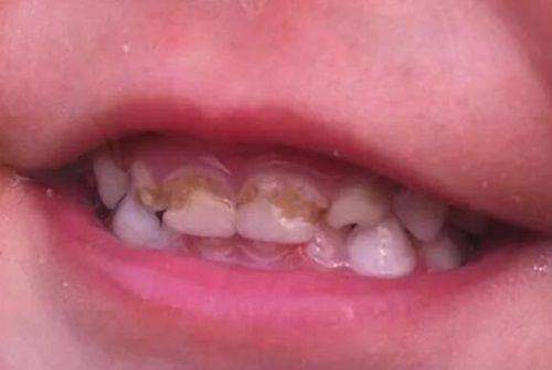 南阳植得口腔医院好不好？正规资质、强医团队、实惠收费，口碑超棒别错过！