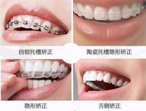 牙齿打桩的基本知识