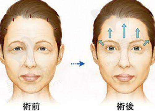 曹美医生特色技术优势