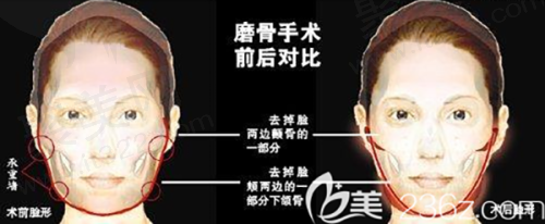 成都八大处整形医院挂号常见问题解答
